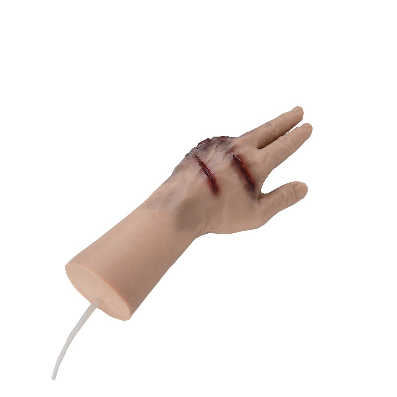 Blast Wound Amputated Fingers Hand Model
