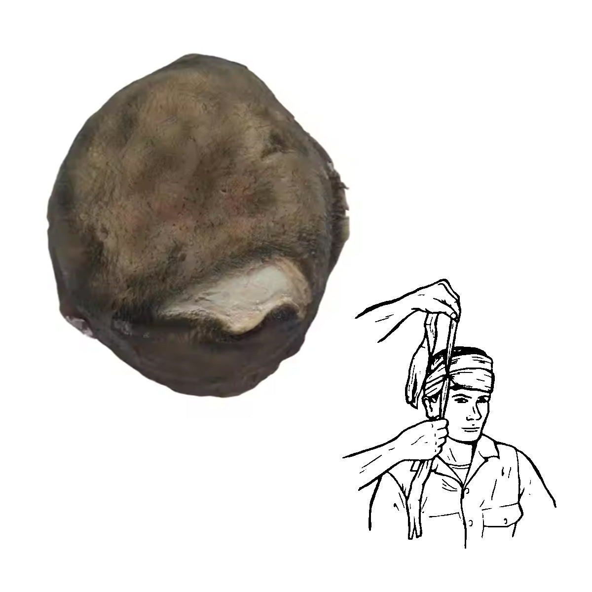 Scalp Wound Packing Training Model