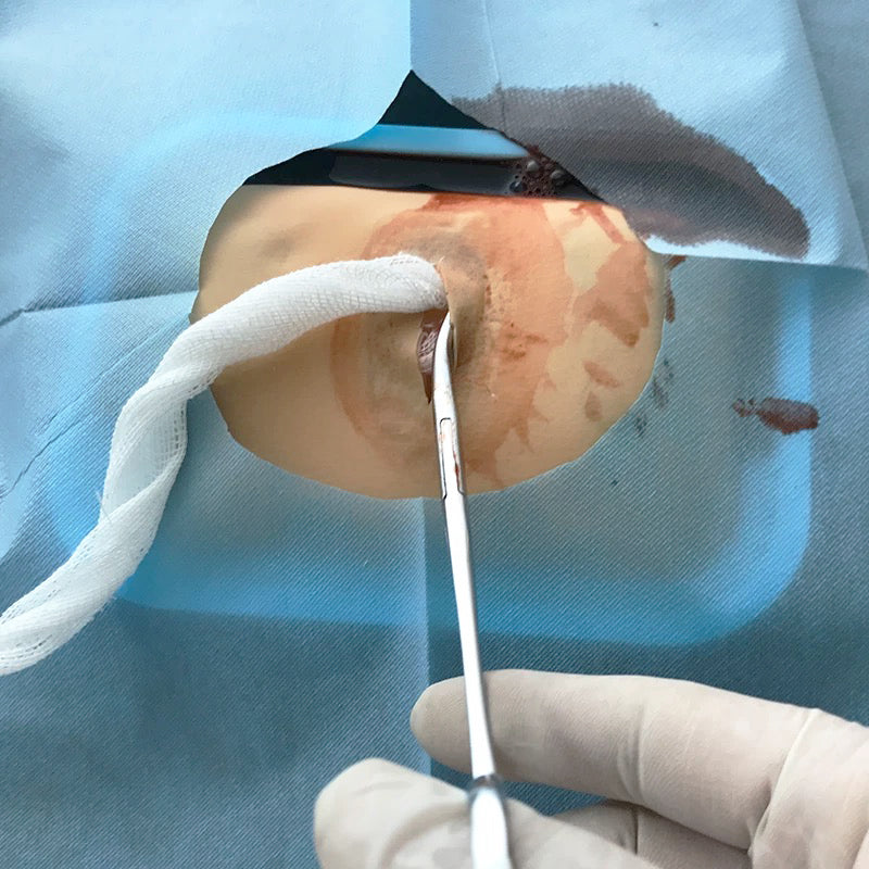 Abscess Drainage Training Model