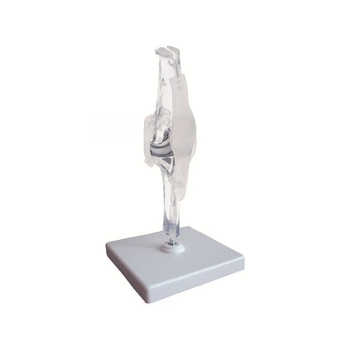 Clear Knee Bone Model with Implants