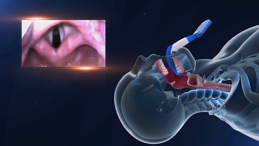 Treatment of Otolaryngology, Head, and Neck Trauma in Combat