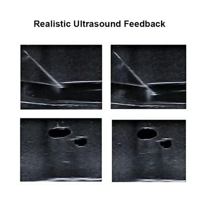Ultrasound Guided Venous and Arterial Access Training Module