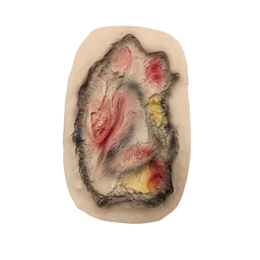Third-Degree Burn Moulage Model for Realistic Training