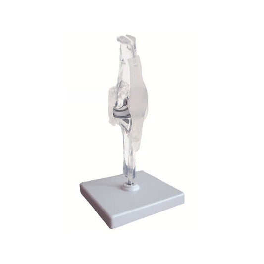 Clear Knee Bone Model with Implants