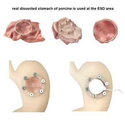 ESD(Endoscopic Submucosal Dissection) Training Model