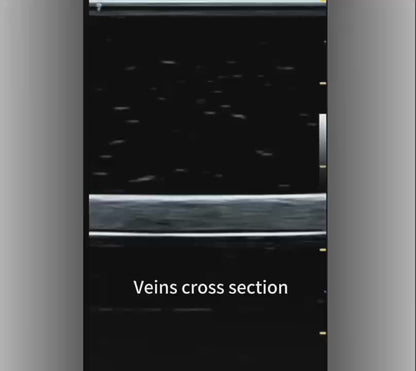 Ultrasound Training Pad with Veins, Nerves, Tumor and Cyst